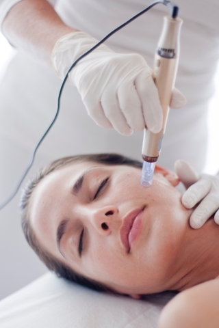 microneedling