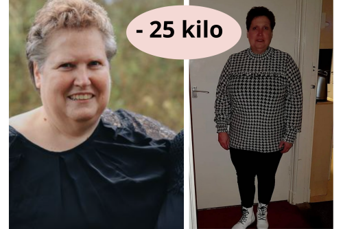 25 kilo kwijt met de virtuele maagband