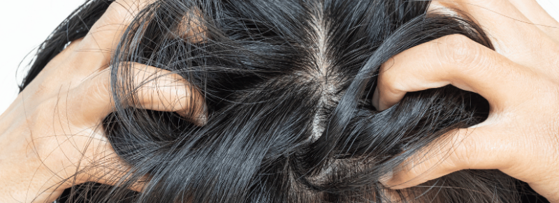 anti haaruitval shampoo anti haaruitval shampoo