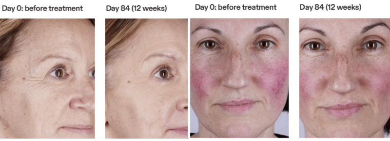 currentbody masker resultaten