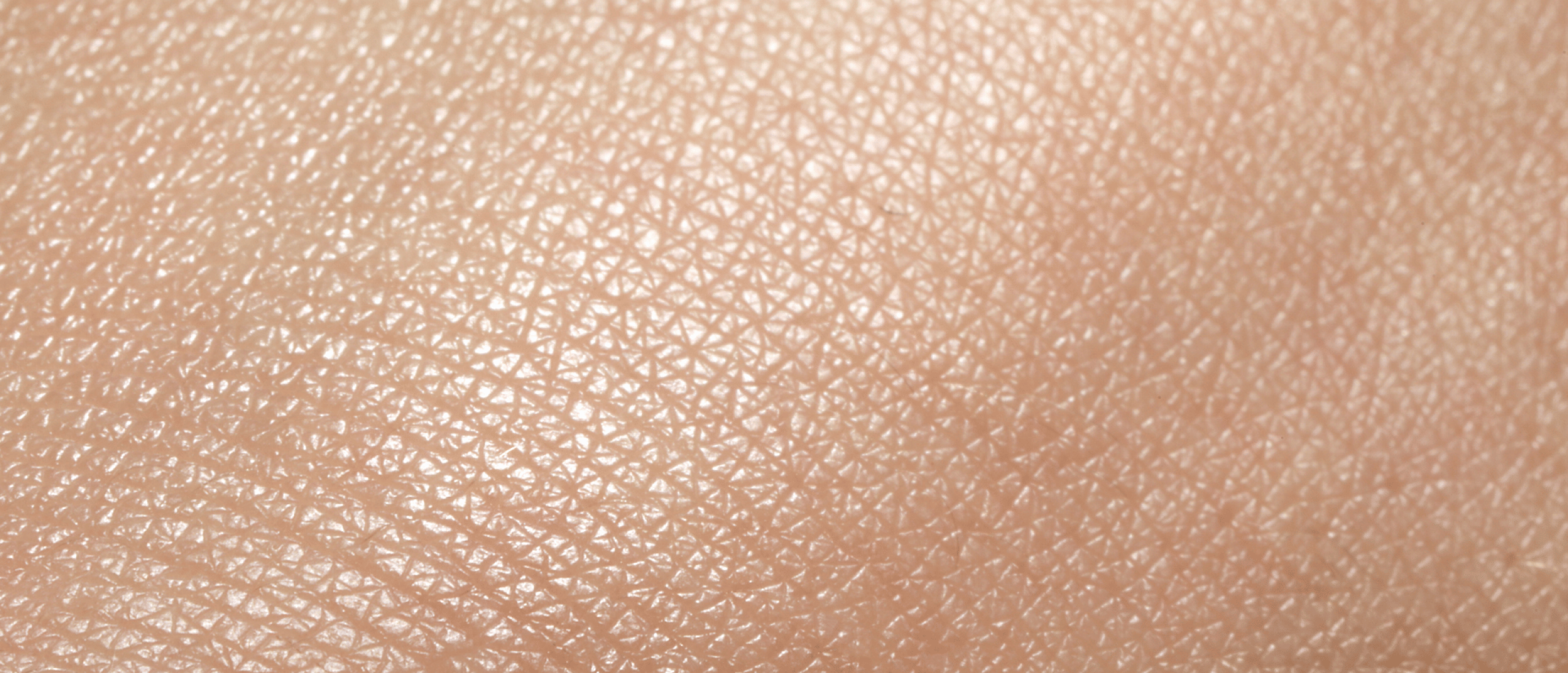 Droge huid winter: hoe kom je snel vanaf?