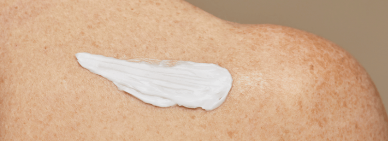 gebruik sudocrem