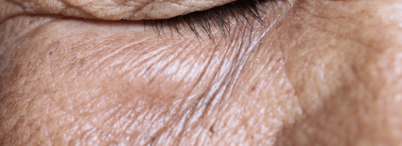 Huidskleur roken Huidskleur roken