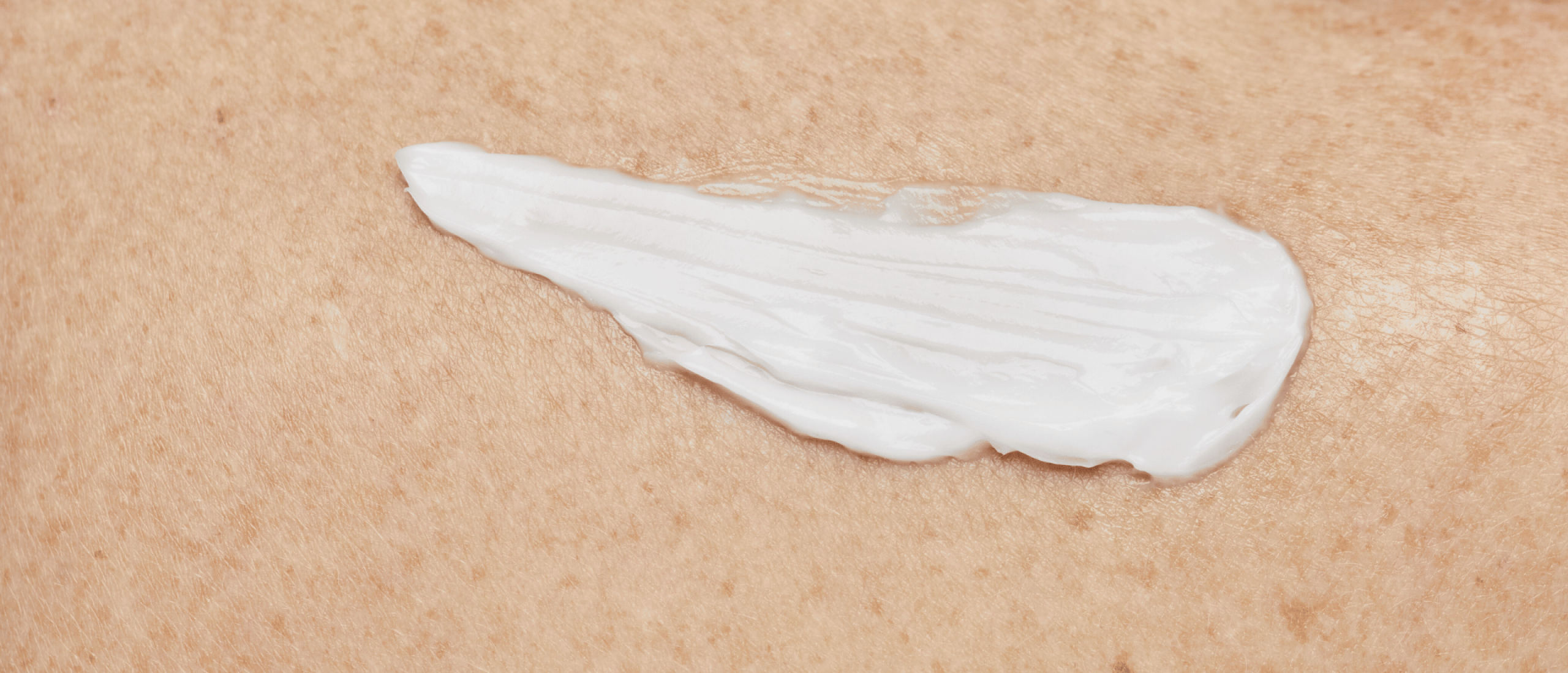 Is Sudocreme goed voor je gezicht?