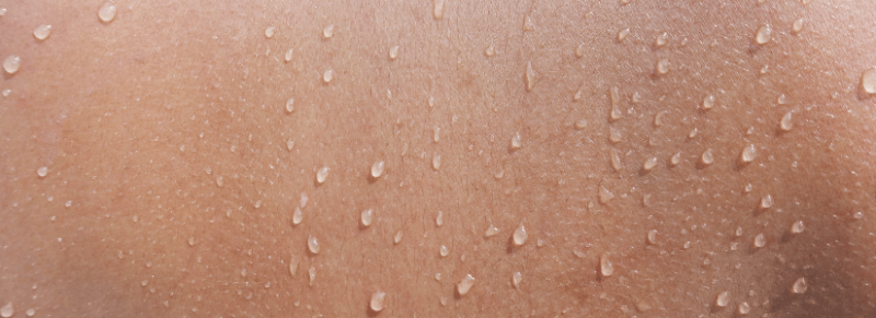 pityriasis versicolor behandelen