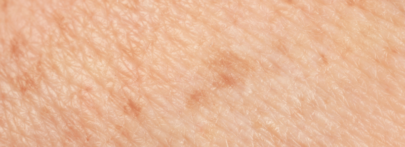 retinol hoe gebruiken beginners retinol hoe gebruiken beginners