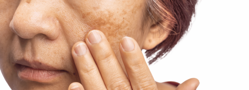 retinol voor eerste rimpels retinol voor eerste rimpels