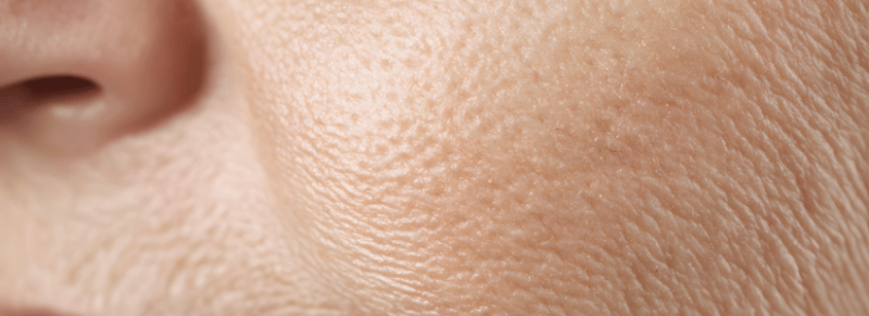 Roken huid Roken huid