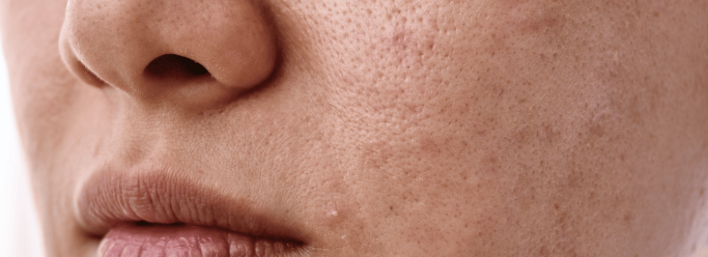 Rokershuid Rokershuid