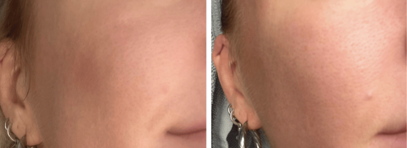 shark facialpro glow