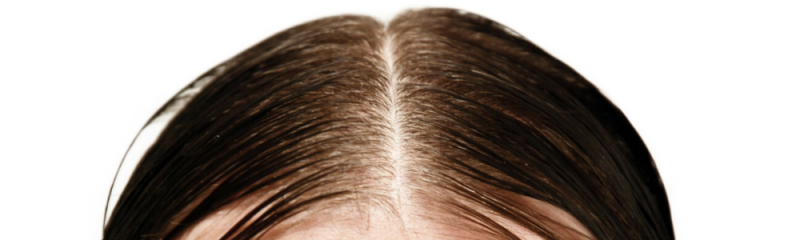 vet haar