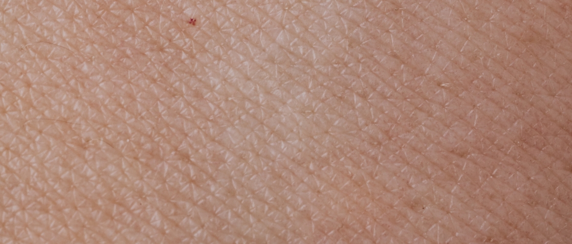 Een droge huid: oorzaak en tips