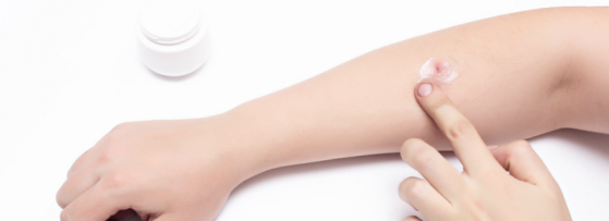 Steenpuist | Oorzaak en behandeling | Sproet