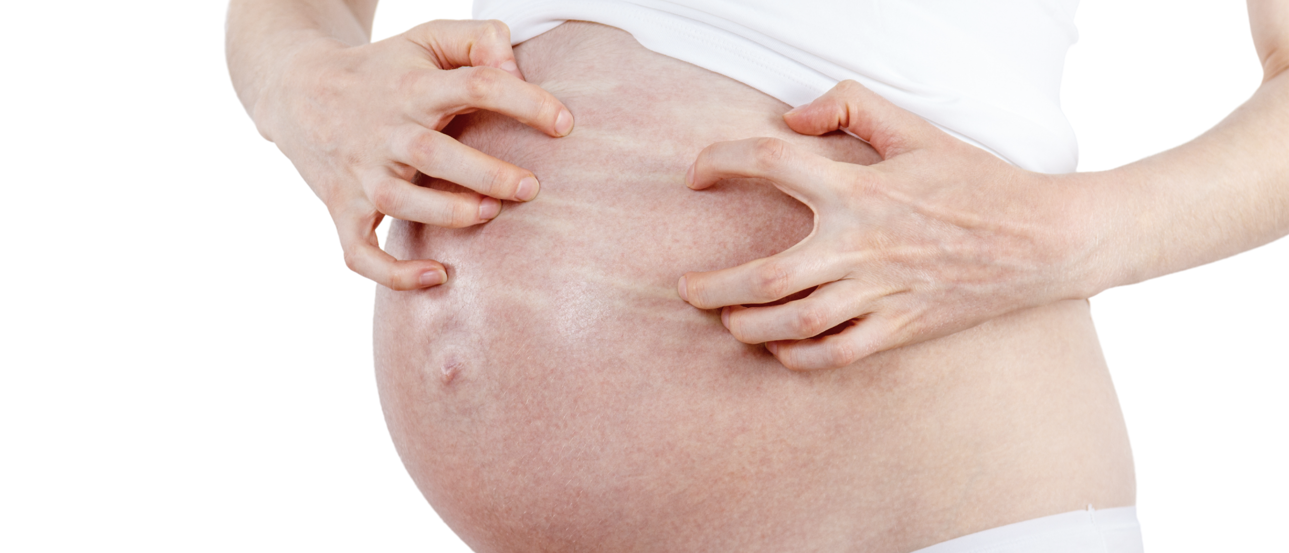Zwangerschapsjeuk: jeukende huid en slijmvliezen