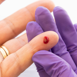 capillair bloedafname emb-test