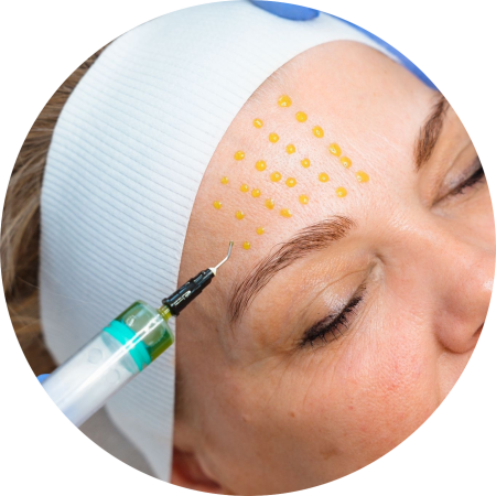 biorepeel-steijaert-huidgezondheid