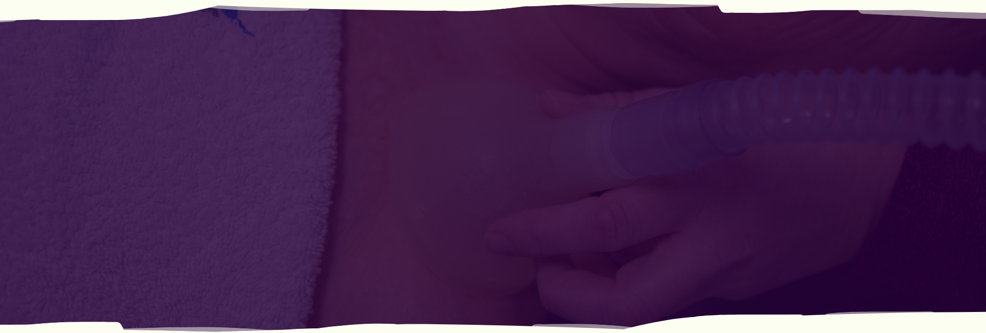 nano-cellcare-therapie-achtergrond-charlotte-steijaert-huidgezondheid
