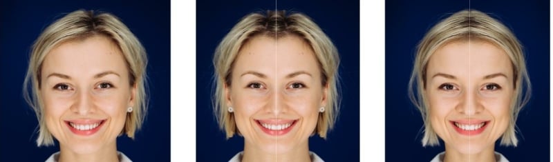 Every face is unique Every face is asymmetrical