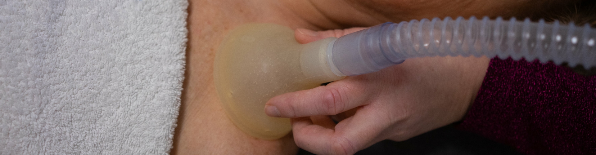 Nano CellCare therapie - Annet Steijaert - Sweet60