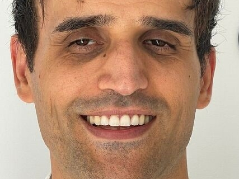 Onze Patienten zijn meestal erg blij met hun nieuwe gebit. Dit komt voornamelijk omdat ze soortgelijke behandelingen in eigen land niet kunnen veroorloven...
