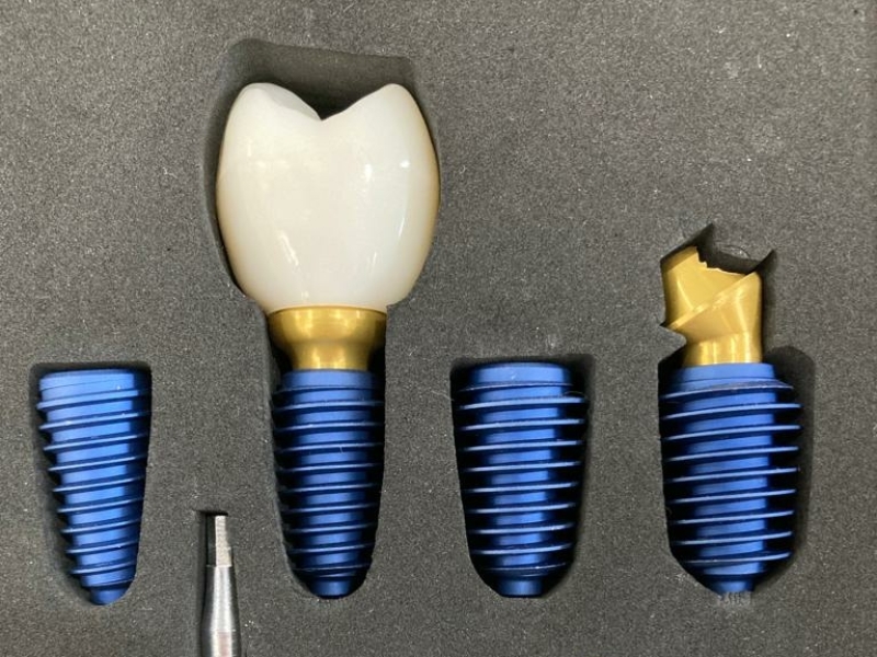 In onze kliniek gebruiken wij exclusief tand implantaten van het Koreaanse merk Megagen. Dit is een merk met 10% internationaal marktaandeel op gebied van implantaten.
