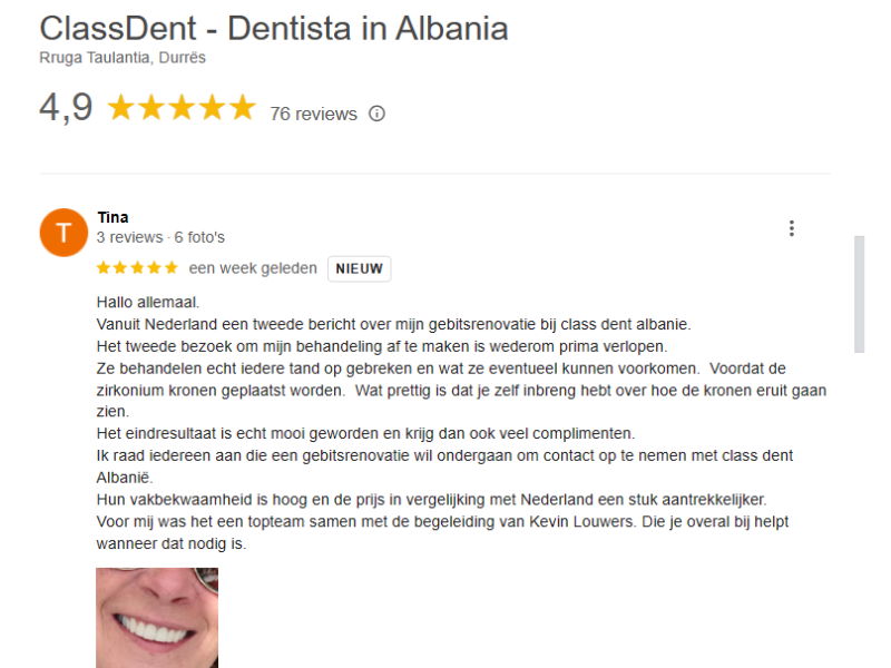 Deze Review liet Tina achter na haar Gebitsrenovatie in onze internationale tandartskliniek...