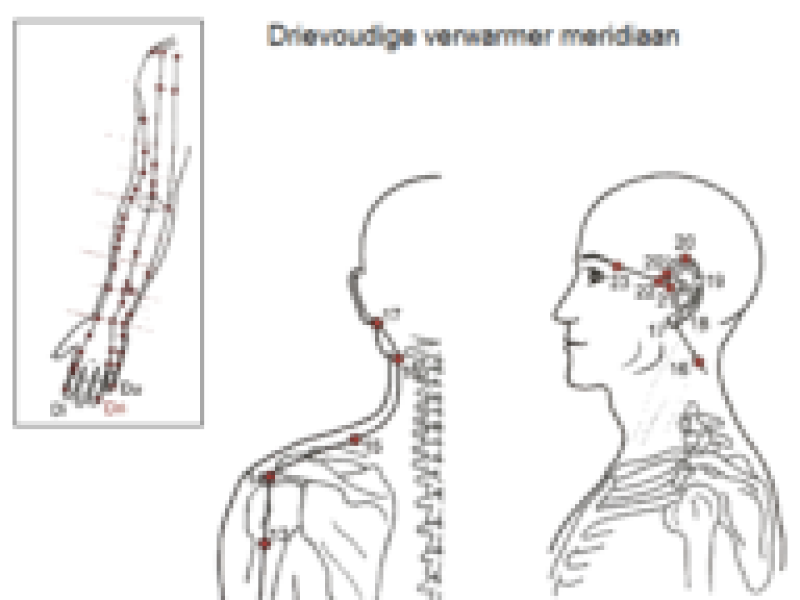 drievoudigeverwarmer meridiaan