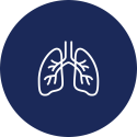 dvt