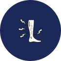 varices