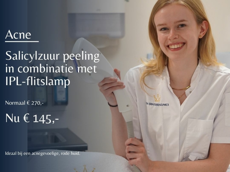 Herfstdeal acnebehandeling peeling met IPL