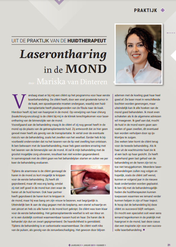 Artikel Mariska van Dinteren over Laserontharing in de mond