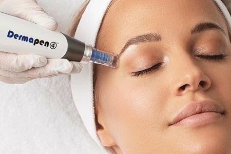 Behandeling Dermapen bij Van Dinteren Clinics