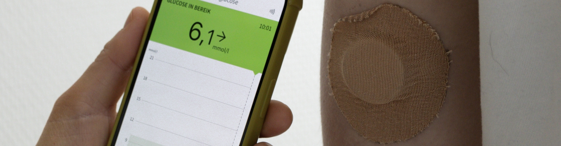 Glucosesensor