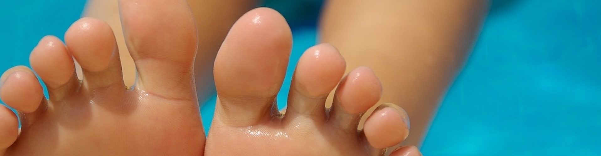 Kalknagels behandelen Utrecht Kalknagels behandelen Utrecht