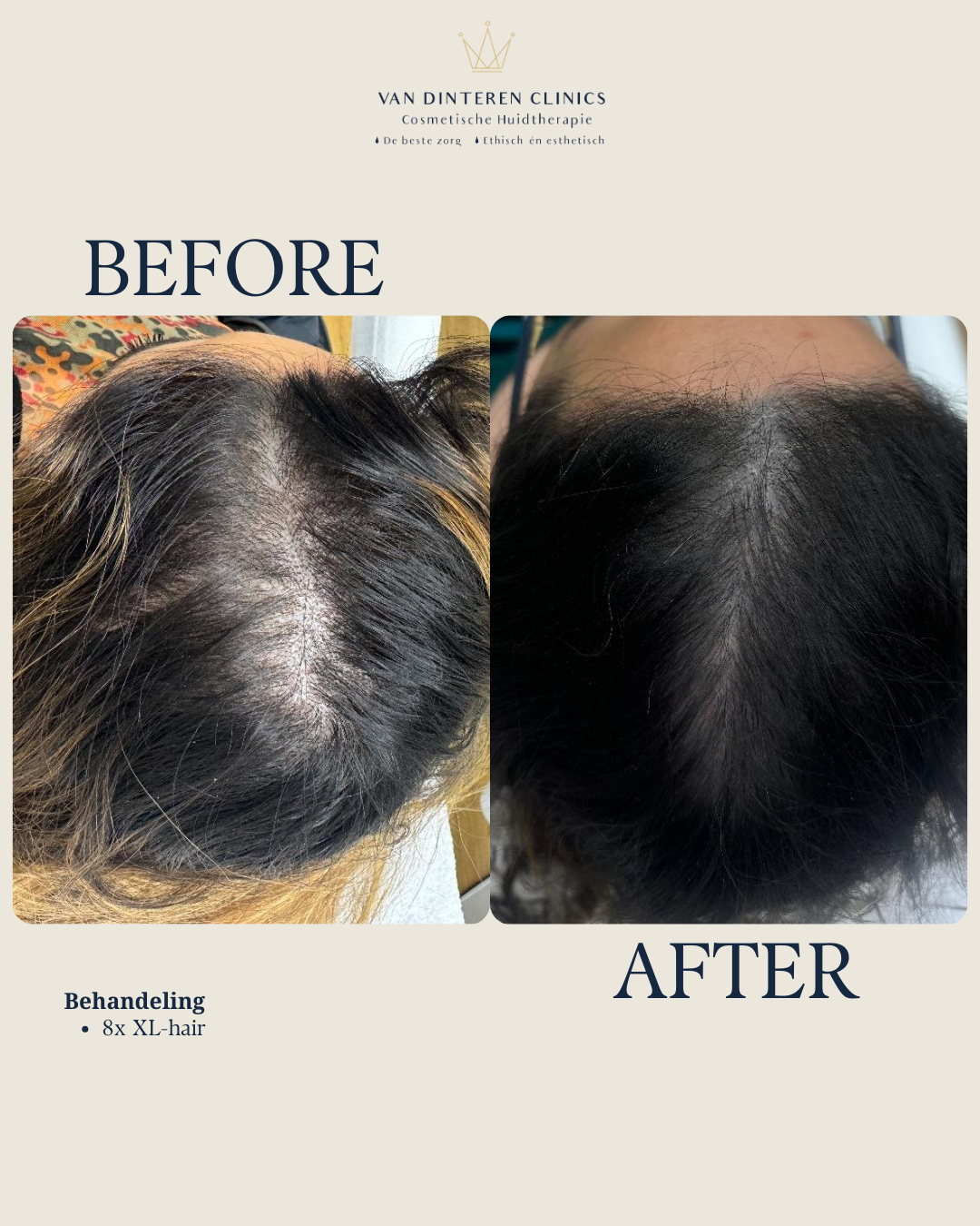 XL hair behandeling Utrecht