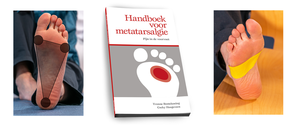 Zo helpt het Handboek voor Metatarsalgie jou