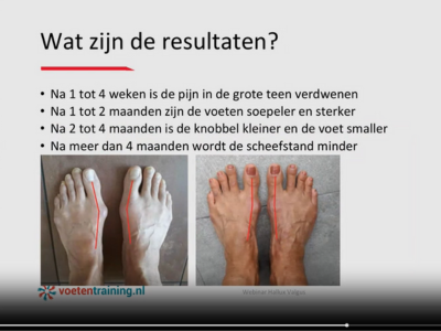 webinar voetentraining