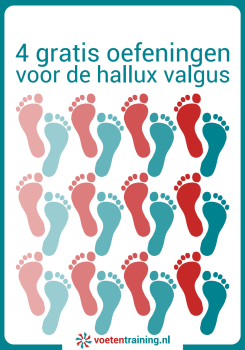 hallux valgus herkennen