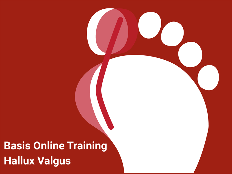 Basis Online Training Hallux Valgus van Voetentraining