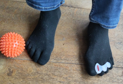 hallux valgus snel en effectief aanpakken
