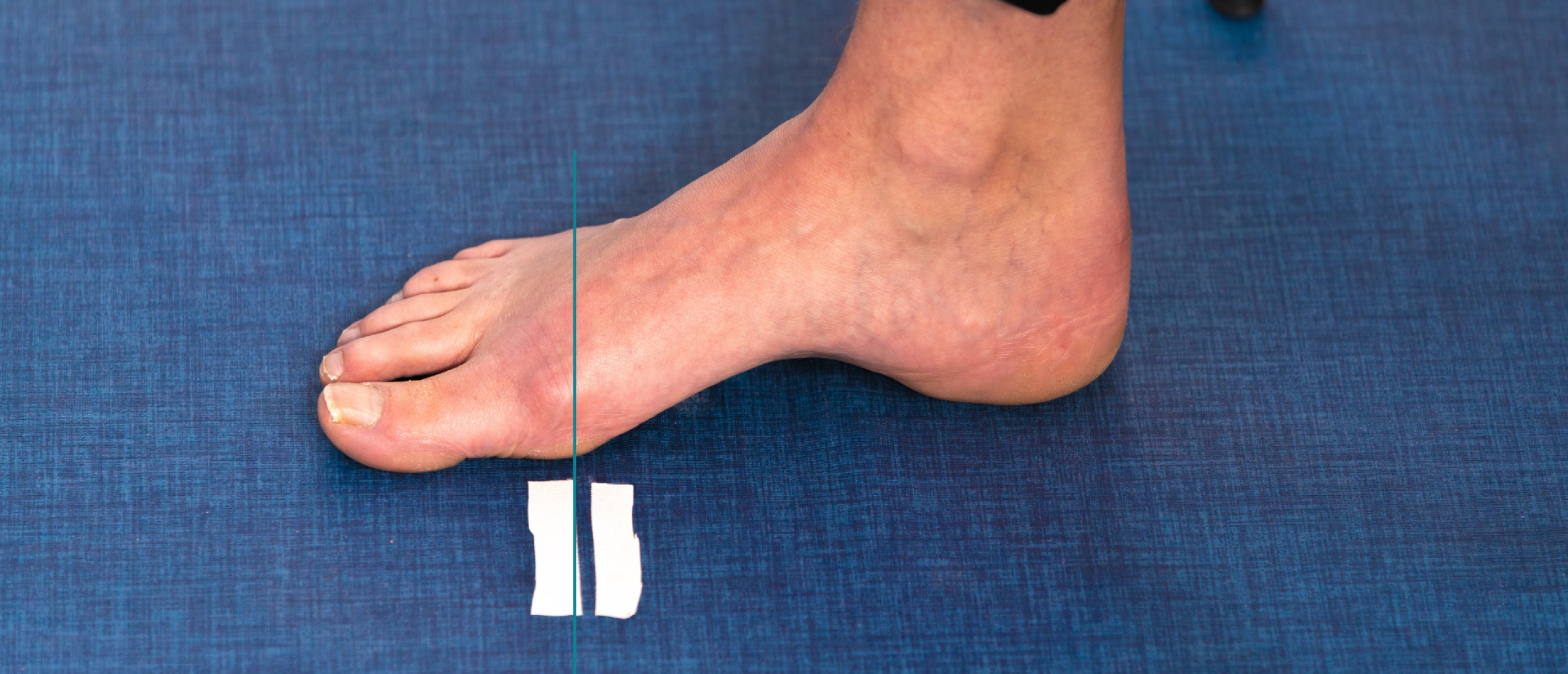 Met de vernieuwde hallux valgus-trainingen van Voetentraining pak je de pijn en scheefstand sneller en effectiever aan.