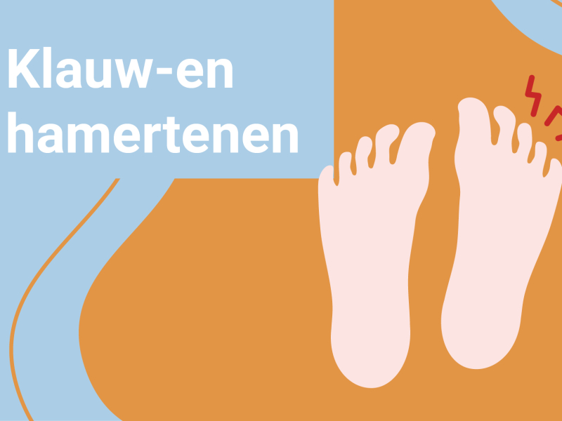 info online training klauw en hamertenen