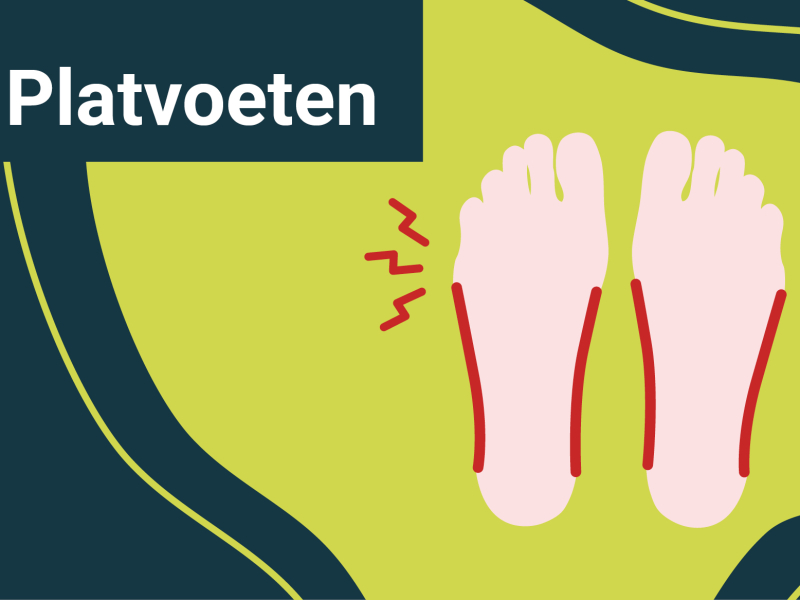 platvoeten aanpakken