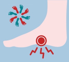 neuropathie oefeningen