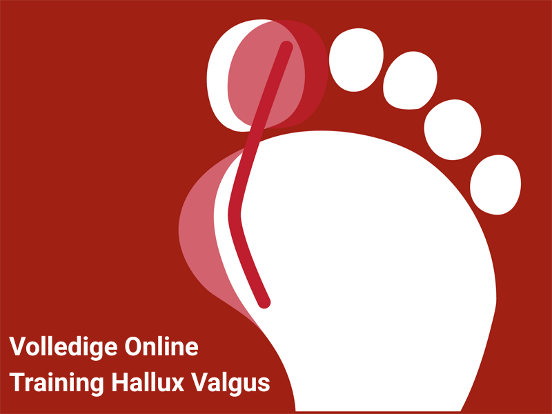 Volledige online traiing Hallux valgus van Voetentraining