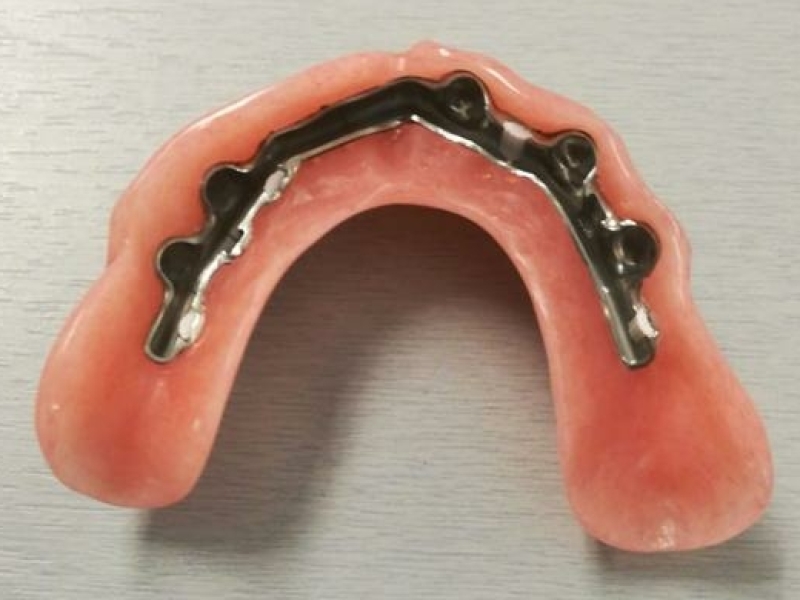 Klikgebit Wesselink Dental