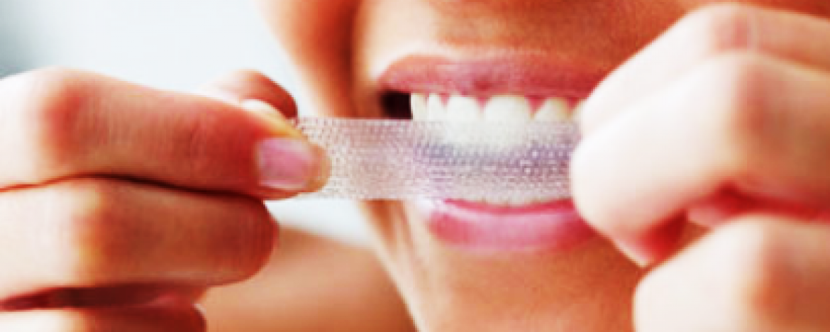 Are Whitening Strips Safe?