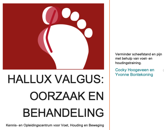 hallux valgus ebook
