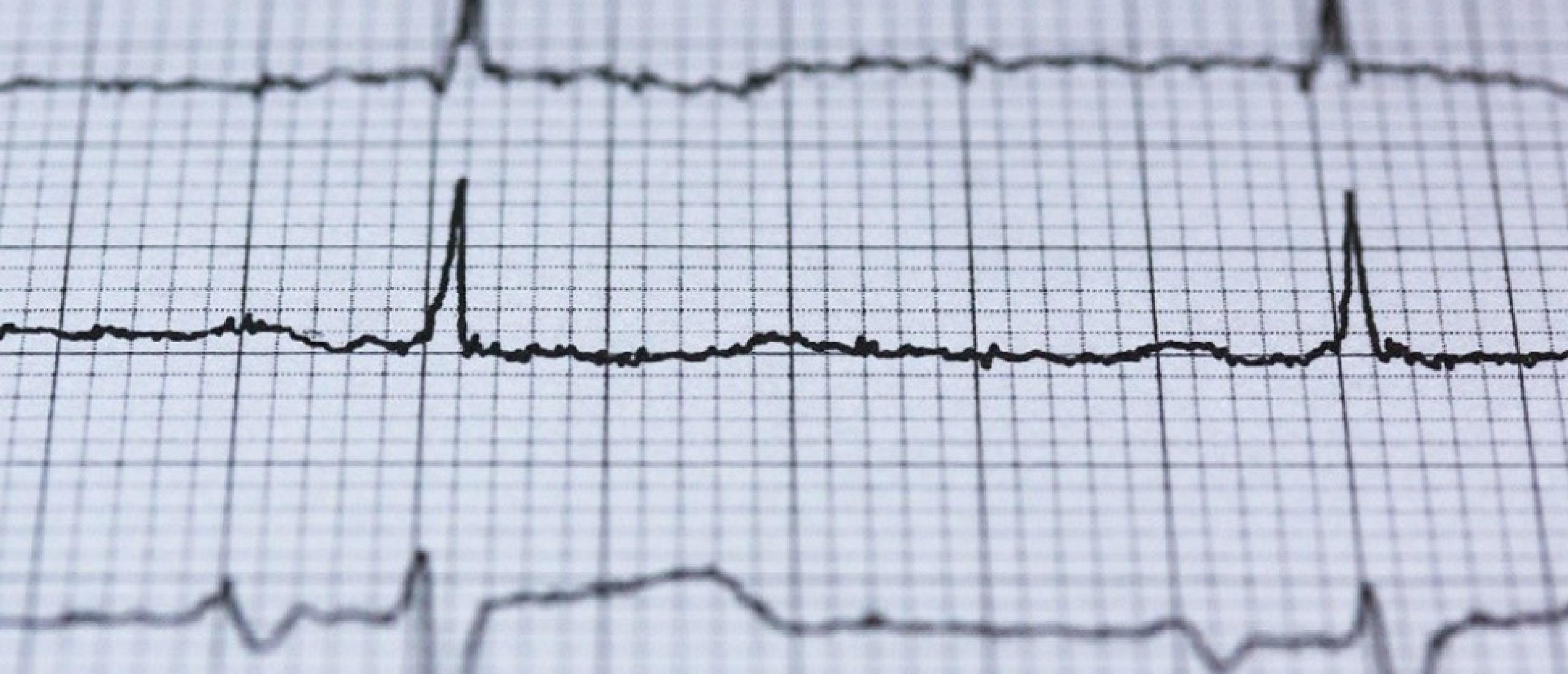 Wat is een hartritmestoornis?