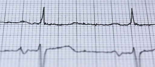 Chronische totale occlusie
